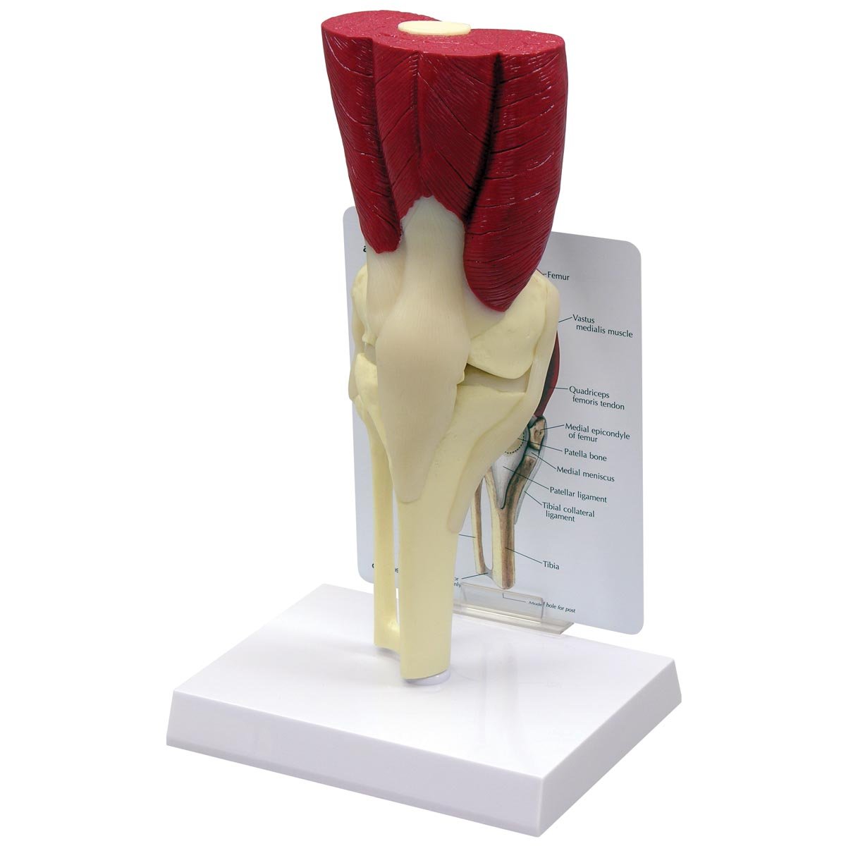 مدل زانو 1060 GPI Anatomicals با عضلات