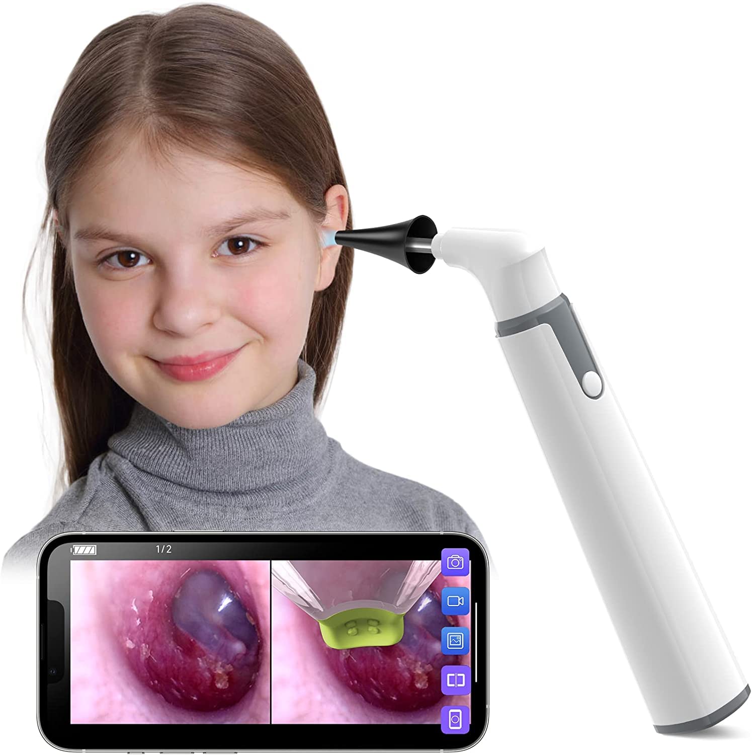 خرید از آمازون - ScopeAround Otoscope، حذف جرم گوش، فوق نازک، اتوسکوپ بی سیم HD با نور، گوش پاک کن با کنترل دما و ژیروسکوپ، آندوسکوپ گوش، سازگار با اندروید و آیفون