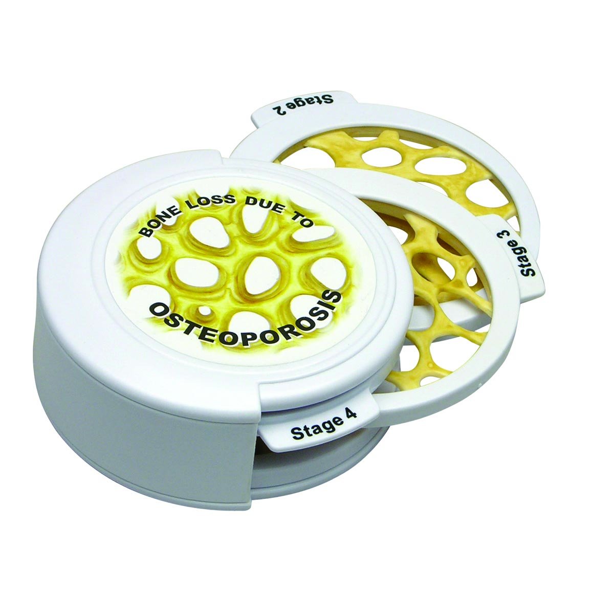 مدل تشریحی 4 دیسک با استخوان پوکی استخوان GPI Anatomicals مدل 1650