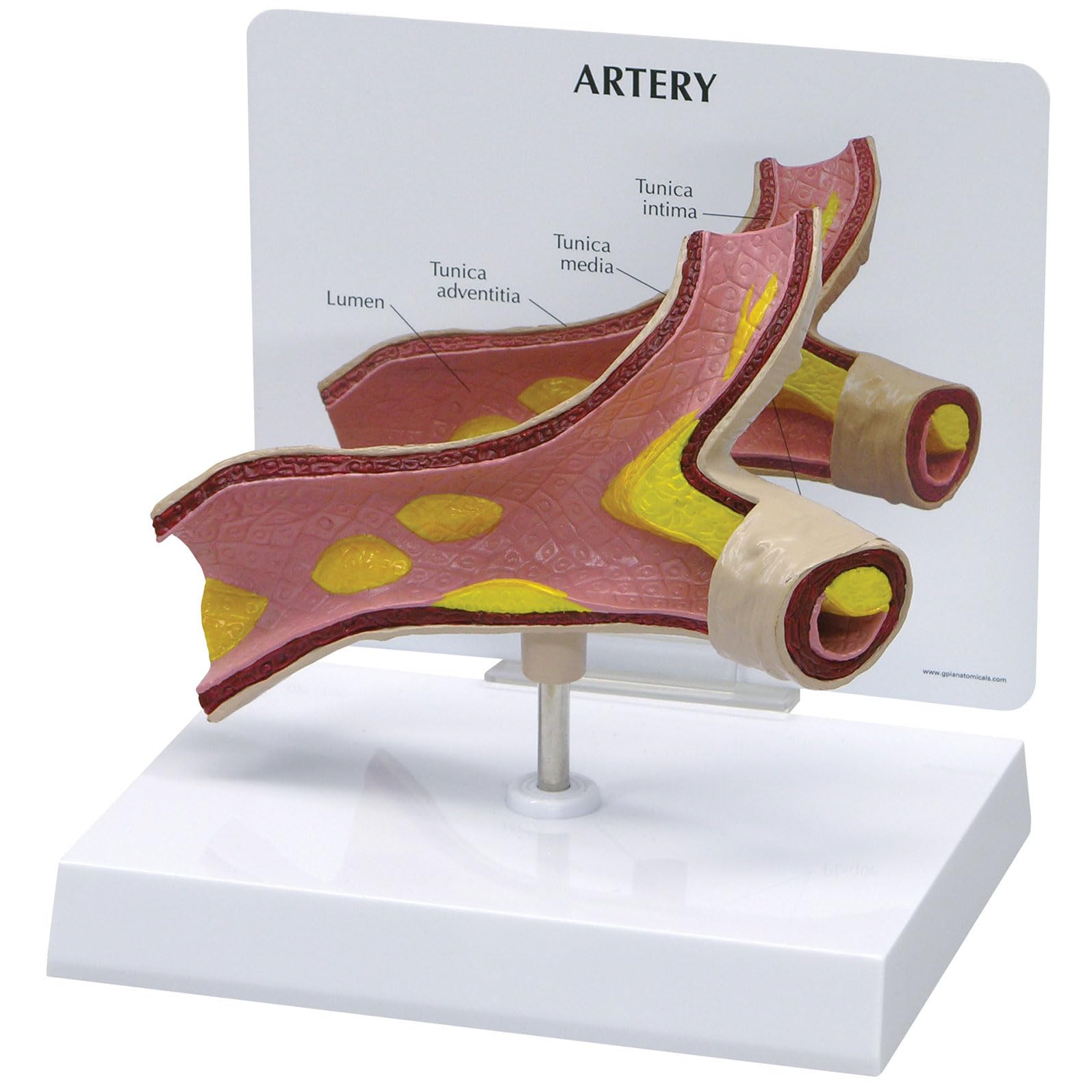 GPI Anatomicals 2600 Arterie Modell