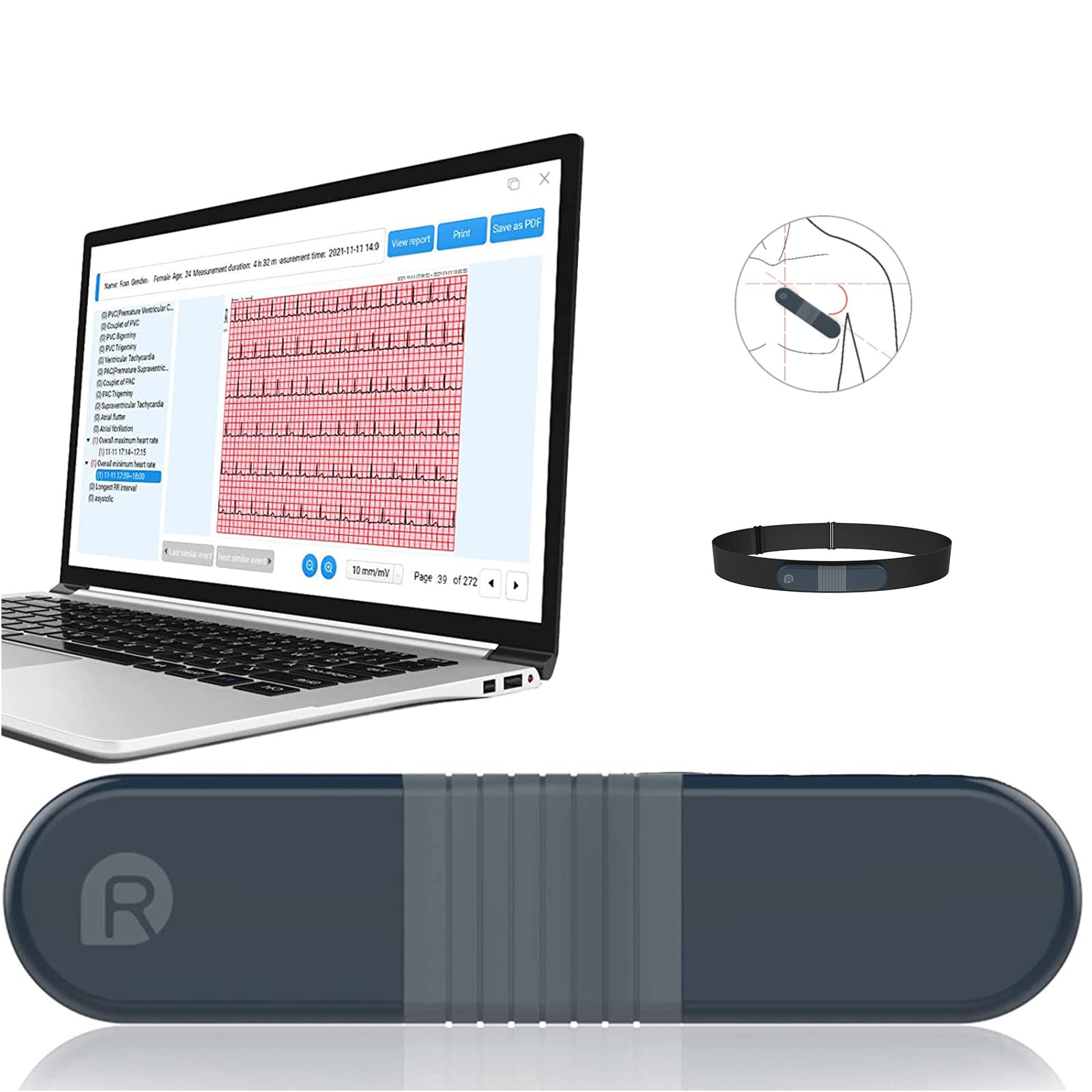 خرید از آمازون - دستگاه ECG 24 ساعته CheckMe با آنالیز AI-ECG برای خانه، دستگاه اندازه گیری نوار سینه، اندازه گیری طولانی مدت برای نرم افزار رایانه شخصی، چاپ PDF شکل موج ECG