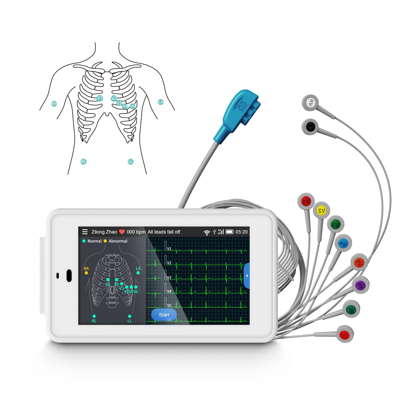خرید از آمازون - دستگاه ECG 12 کاناله Wellue Portable، دستگاه ECG دیجیتال با الگوریتم گلاسکو برای تجزیه و تحلیل خودکار داده های ECG، پشتیبانی از انتقال داده های WIFI/USB و چاپ گزارش، برای PCECG خانگی