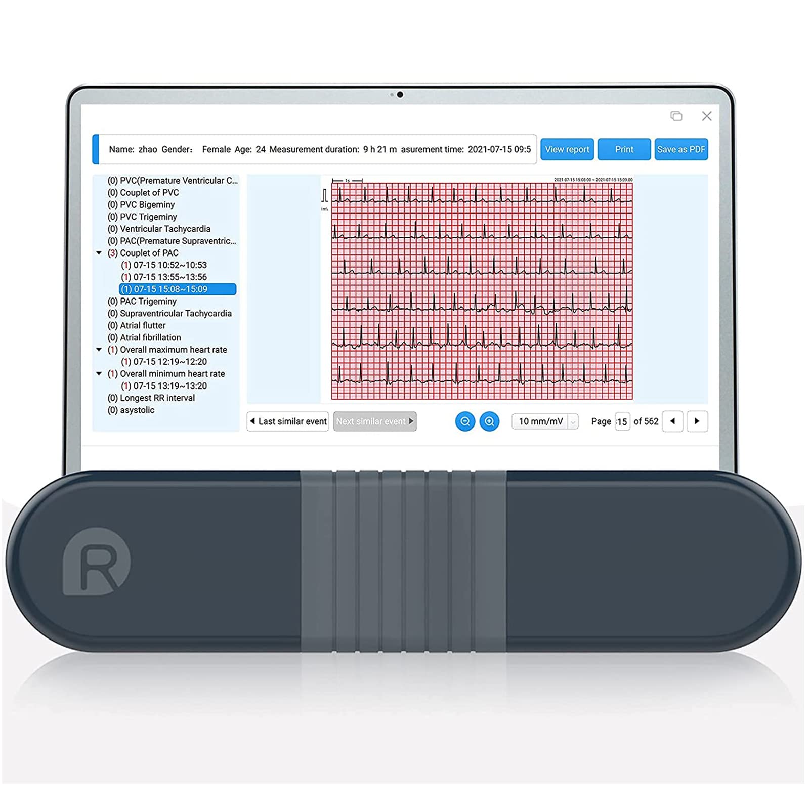 خرید از آمازون - مانیتور نوار قلب Wellue، هولتر ضبط حرفه ای با گزارش آنالیز AI-ECG، ضبط هولتر 24 ساعته ECG، پشتیبانی از نرم افزار رایانه شخصی، ردیاب سلامت قلب قابل حمل برای مصارف خانگی