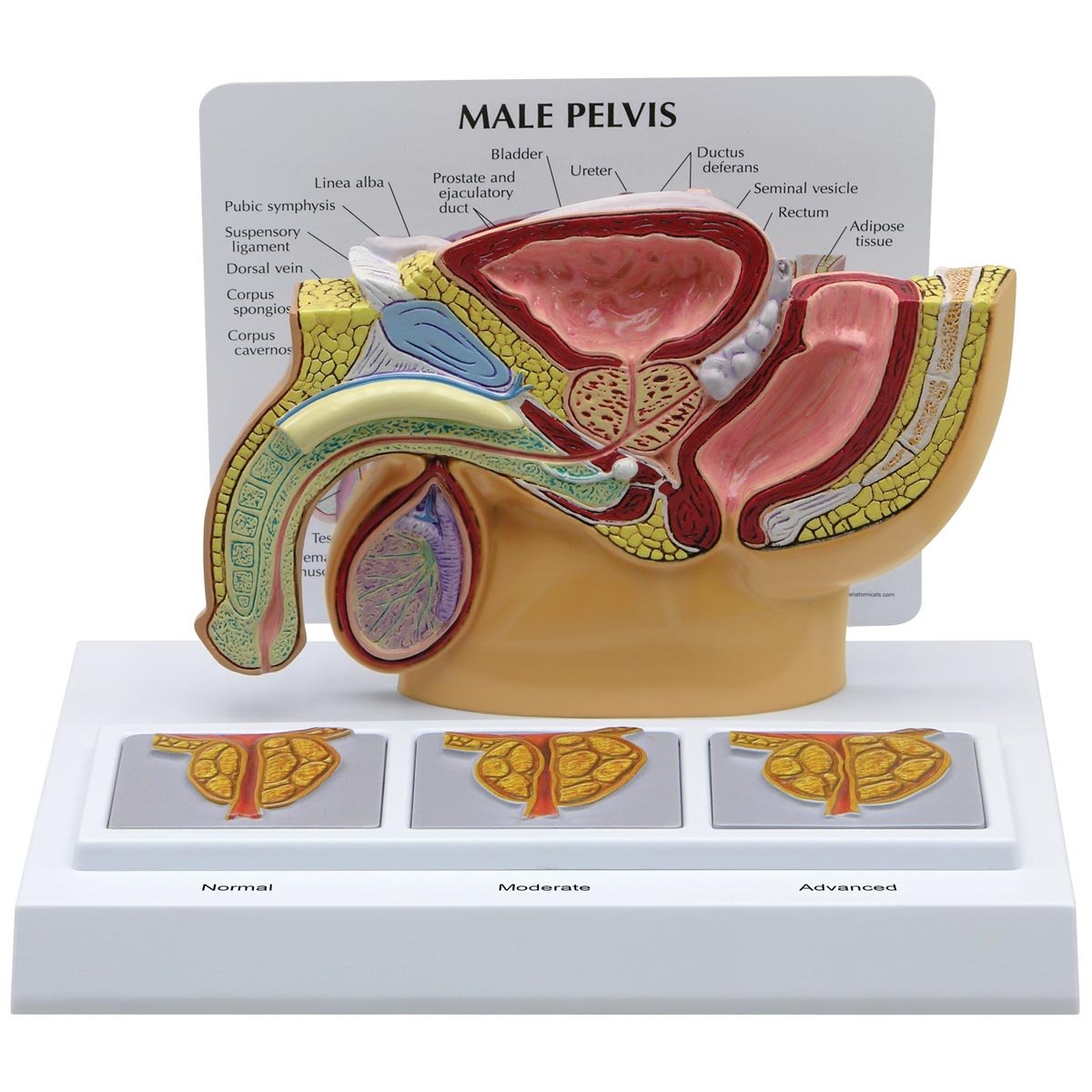 مدل تشریحی لگن مردانه با پروستات 3D GPI Anatomicals 3551 سه بعدی