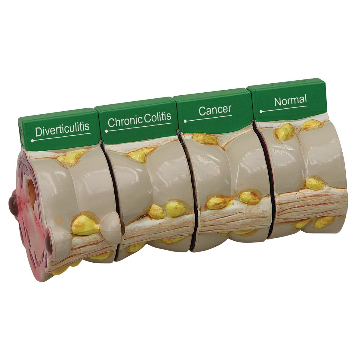 مدل GPI Anatomicals 3341 Colon 4 Slice