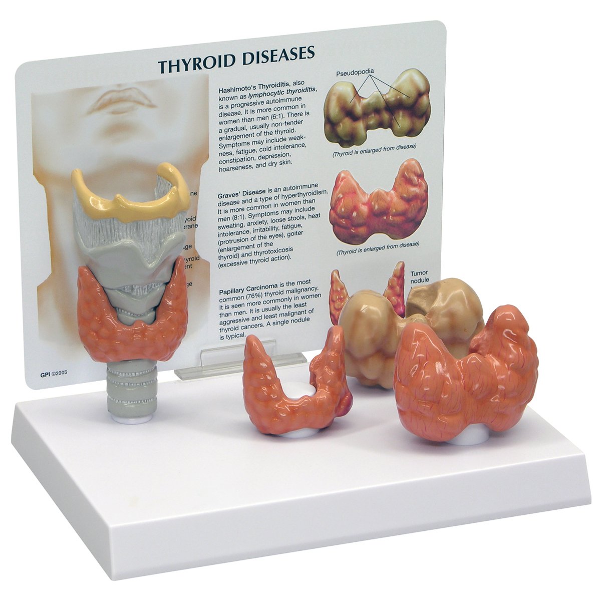 GPI Anatomicals W33370 Thyroid Model, 1019548