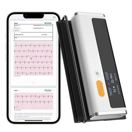 خرید از ایبی - مانیتور فشار خون بالای بازو هوشمند بلوتوث با دستگاه ECG برنامه رایگان