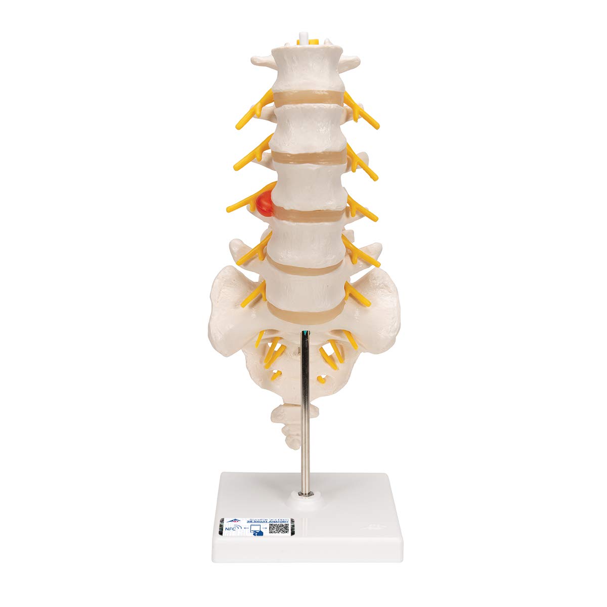 مدل تشریحی ستون فقرات کمری با فتق دیسک دُرسولاترال + اپلیکیشن آناتومی رایگان 3B Smart Anatomy