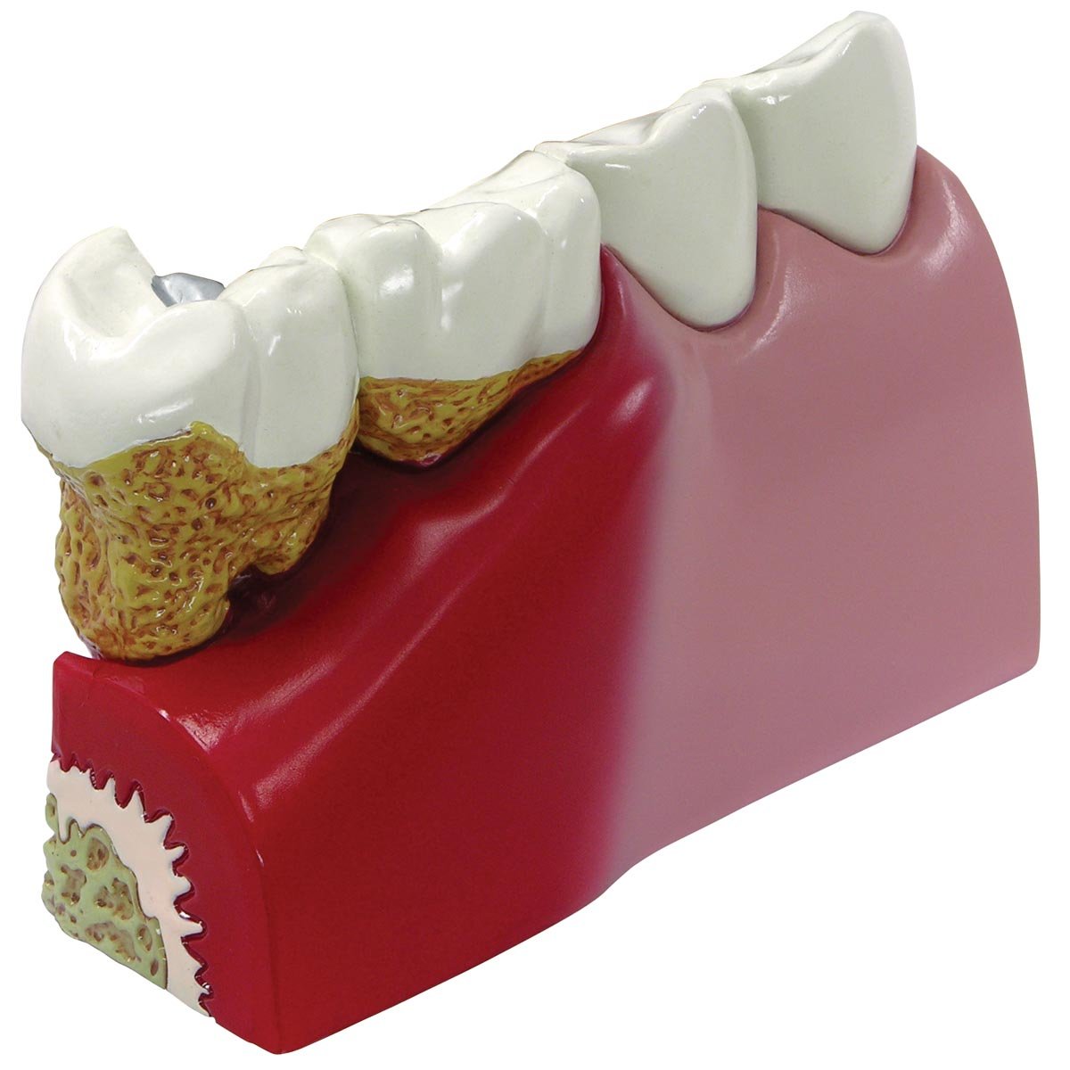 مدل تشریحی دندان‌ها GPI Anatomicals 2860