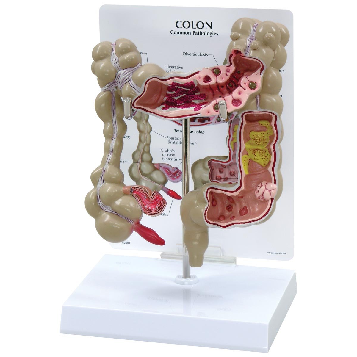مدل روده بزرگ GPI Anatomicals W33364