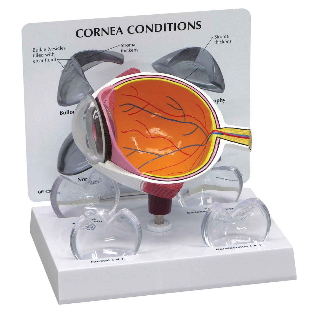 GPI Anatomicals 2780 Eye Model Cornea