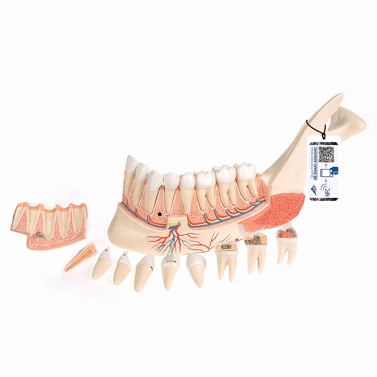 مدل تشریحی نیمه فک پایین با 8 دندان کرم‌خورده، 19 قطعه - 3B Scientific همراه با اپلیکیشن رایگان 3B Smart Anatomy