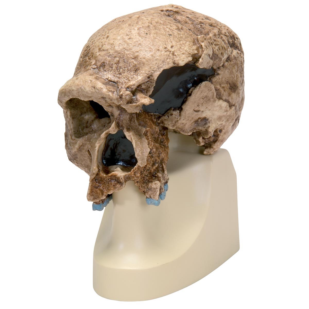 3B Scientific - ماکت جمجمه Homo steinheimnensis (برکهمر، 1936)