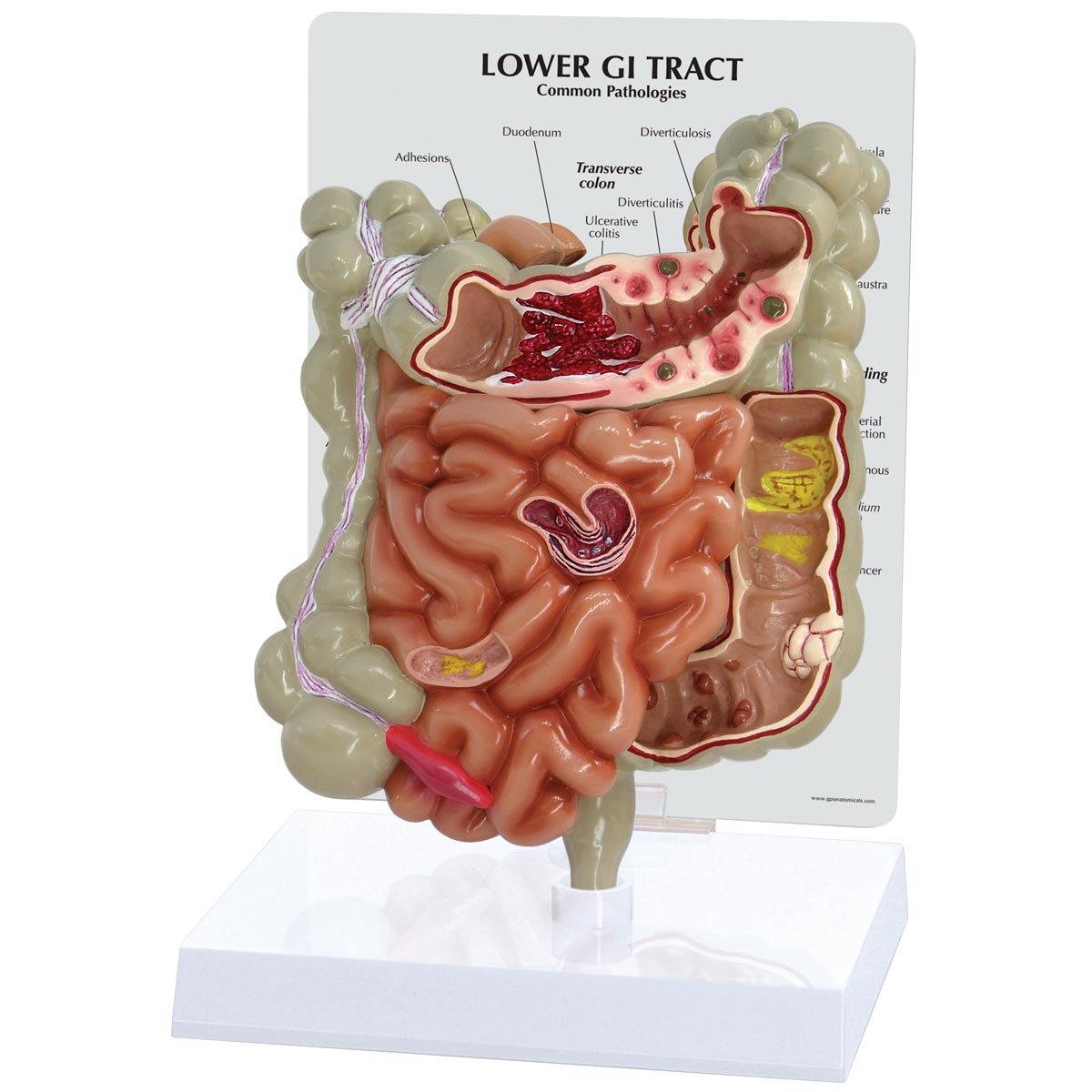 GPI Anatomicals 3342 مدل دستگاه گوارش، 1019556