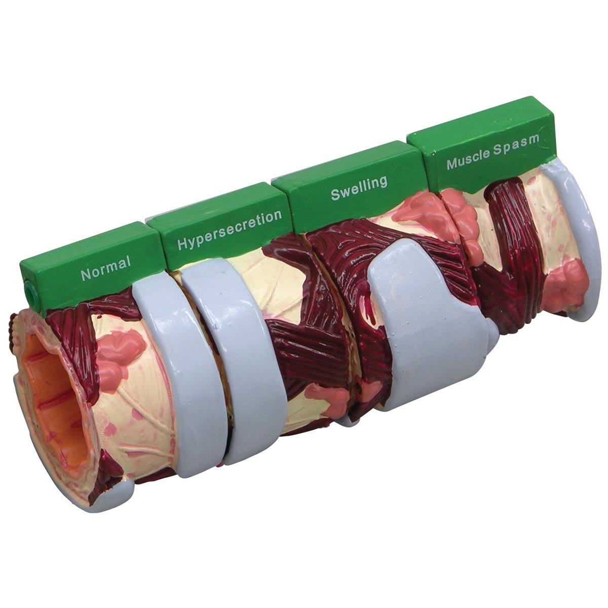 مدل 4 مرحله ای برونش GPI Anatomicals W33362