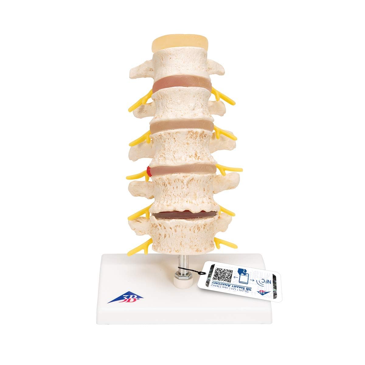 مدل تشریحی مراحل فتق دیسک و تخریب مهره‌ها 3B Scientific + اپلیکیشن رایگان 3B Smart Anatomy، مدل A795