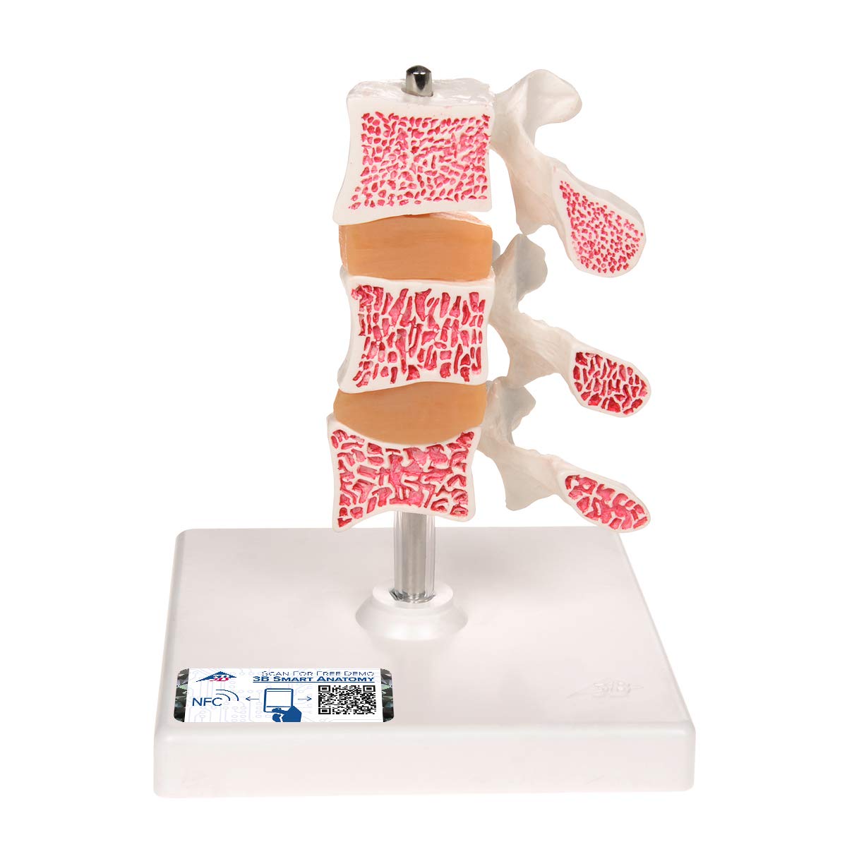 مدل تشریحی پوکی استخوان با 3 مهره کمری 3B Scientific، روی استند + اپلیکیشن رایگان 3B Smart Anatomy، مدل لوکس