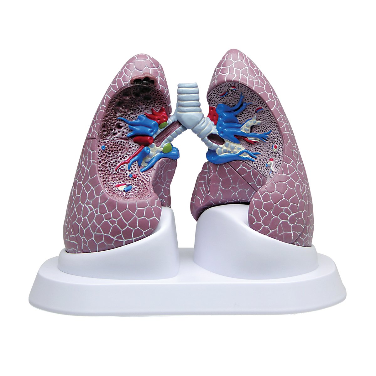 GPI Anatomicals 3110 Lung Set with Pathology, 1018749