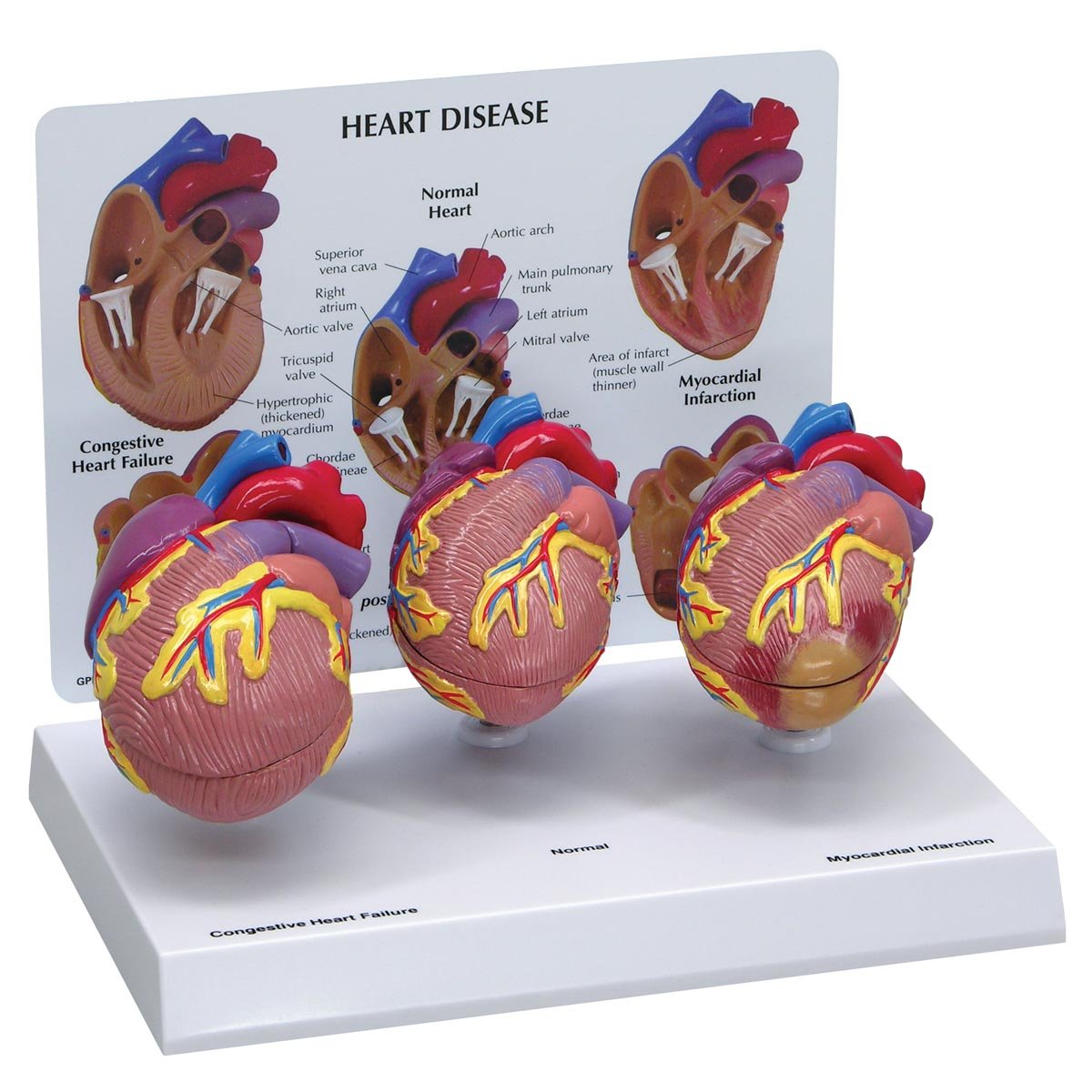 ست مینی مدل GPI Anatomicals W33365 Herz Modell