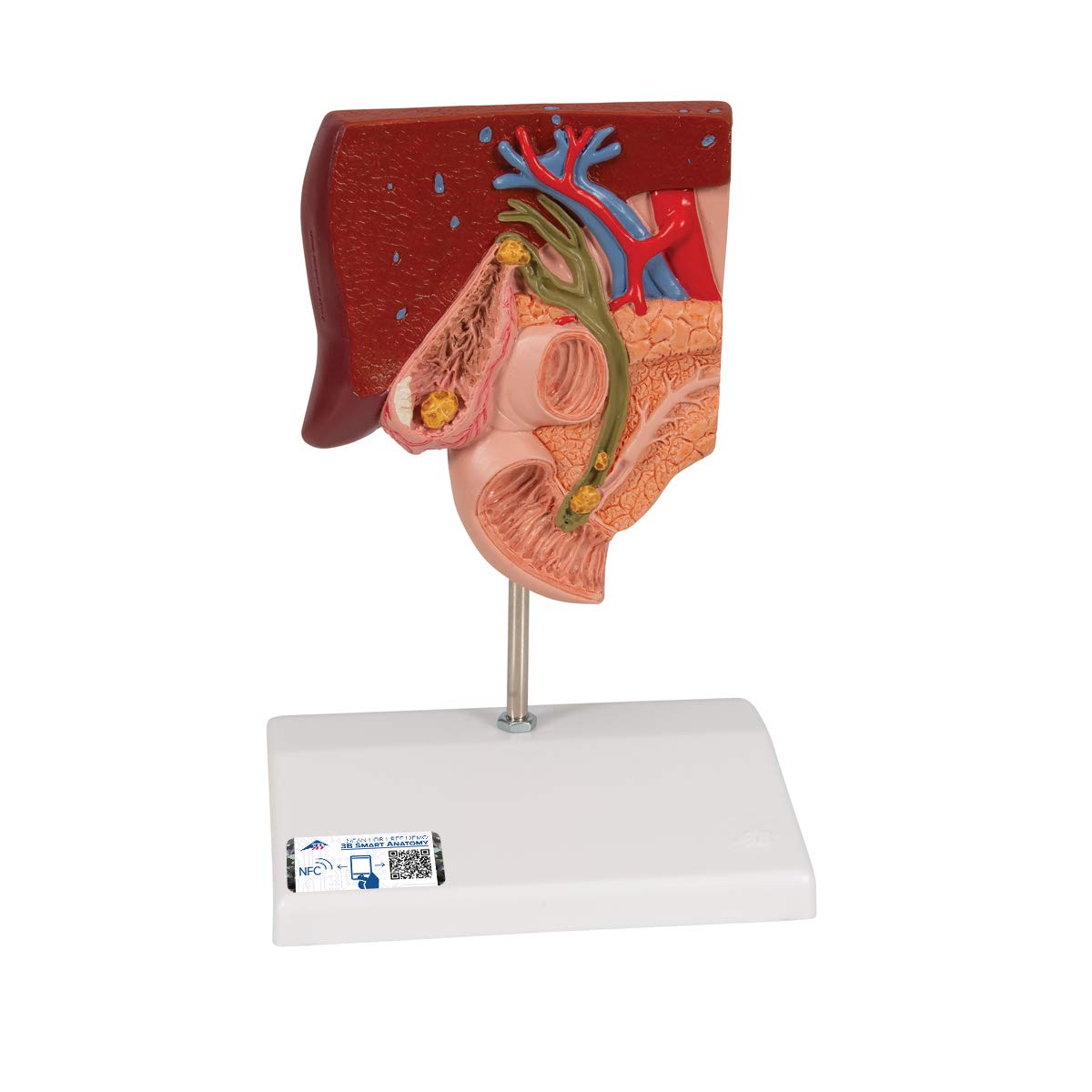 3B Scientific Human Anatomy - مدل سنگ کیسه صفرا + برنامه رایگان آناتومی - 3B Smart Anatomy