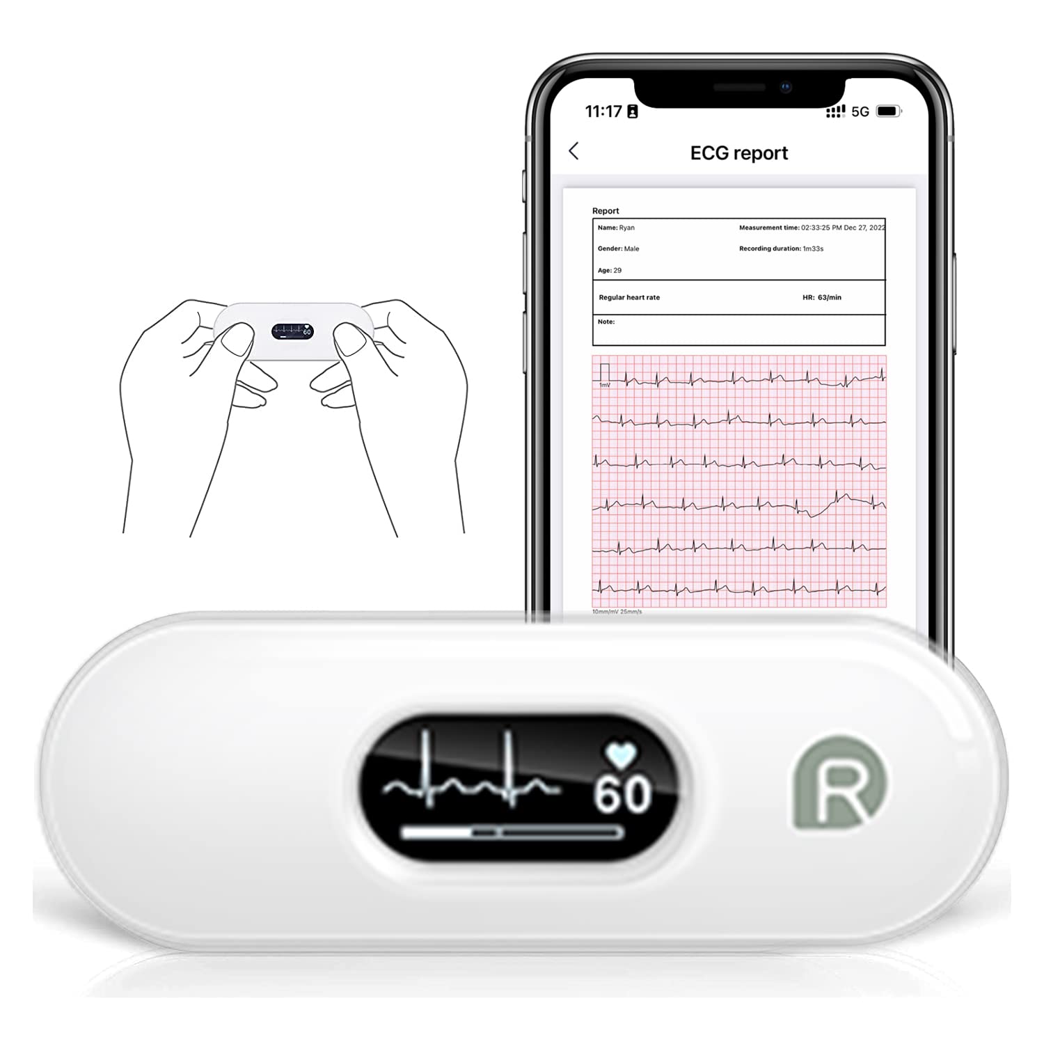 خرید از آمازون - دستگاه ECG همراه Wellue DuoEK-S، مانیتور قلب قابل حمل بی سیم بلوتوث با صفحه نمایش OLED 0.96 اینچی، مانیتورینگ 30s - 5 دقیقه، مانیتور ضربان قلب، برنامه برای iOS و Android