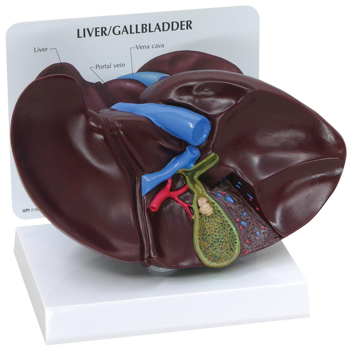GPI Anatomicals 3300 مدل کبد/کیسه صفرا