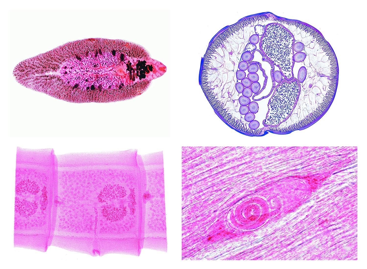 سری لیِدر - انگل‌شناسی LIEDER Serie - Parasitologie