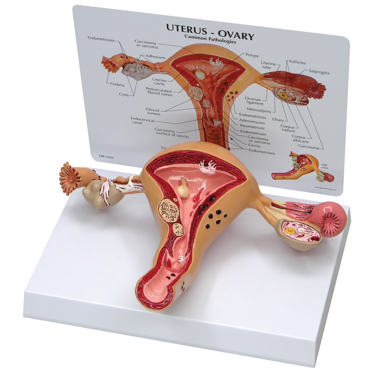 مدل تشریحی رحم GPI Anatomicals W33352
