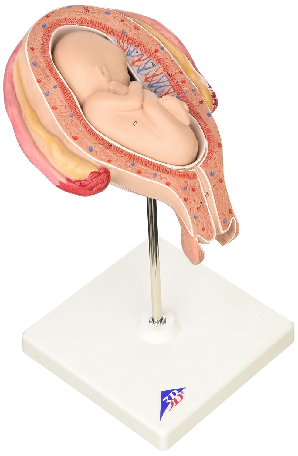مدل تشریحی جنین انسان، 5 ماهه در وضعیت بریچ Breech (Steißlage) - 3B Scientific